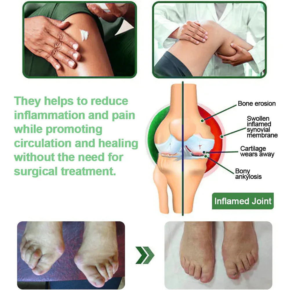 💗🎁💗Final 3 Hours: 60% OFF 𝐎𝐟𝐟𝐢𝐜𝐢𝐚𝐥 𝐒𝐭𝐨𝐫𝐞: 𝐎𝐮𝐫𝐥𝐲𝐚𝐫𝐝® Chillflex Mint Pain Relief Cream
