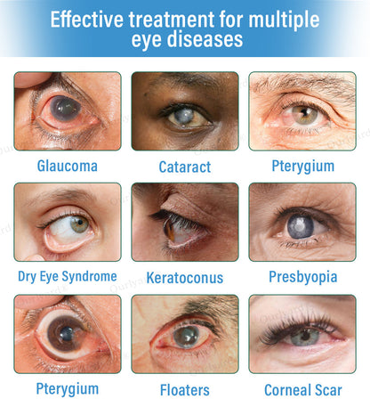 👓Ourlyard® Supramolecular Eye Drops ✅MHRA approved (Suitable for cataracts, floaters, AMD and presbyopia) 🌵 (Copy)