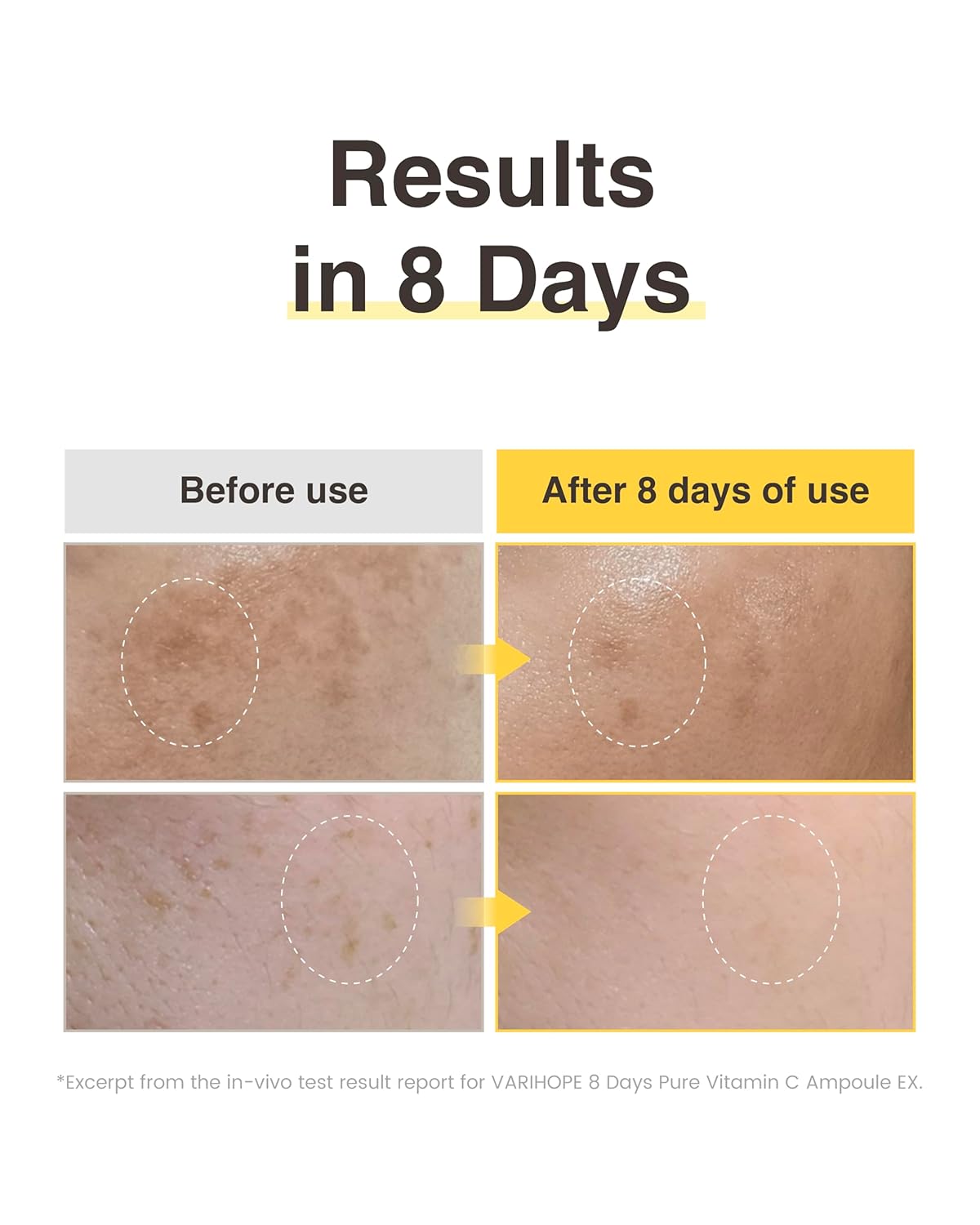 💗💗Final 3 Hours: 60% OFF 8 Day Vitamin C Serum