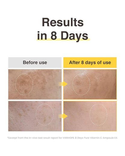 💗💗Final 3 Hours: 60% OFF 8 Day Vitamin C Serum