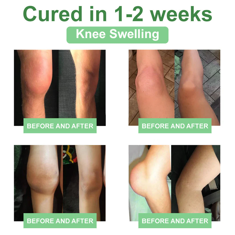 🎁𝐎𝐟𝐟𝐢𝐜𝐢𝐚𝐥 𝐒𝐭𝐨𝐫𝐞: 𝐎𝐮𝐫𝐥𝐲𝐚𝐫𝐝® Chillflex Mint Pain Relief Cream Revolutionary FDA-approved cream eliminates chronic pain in just 48 hours – no pills, no $1,000s in medical bills!