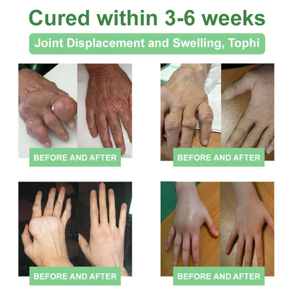🎁𝐎𝐟𝐟𝐢𝐜𝐢𝐚𝐥 𝐒𝐭𝐨𝐫𝐞: 𝐎𝐮𝐫𝐥𝐲𝐚𝐫𝐝® Chillflex Mint Pain Relief Cream Revolutionary FDA-approved cream eliminates chronic pain in just 48 hours – no pills, no $1,000s in medical bills!