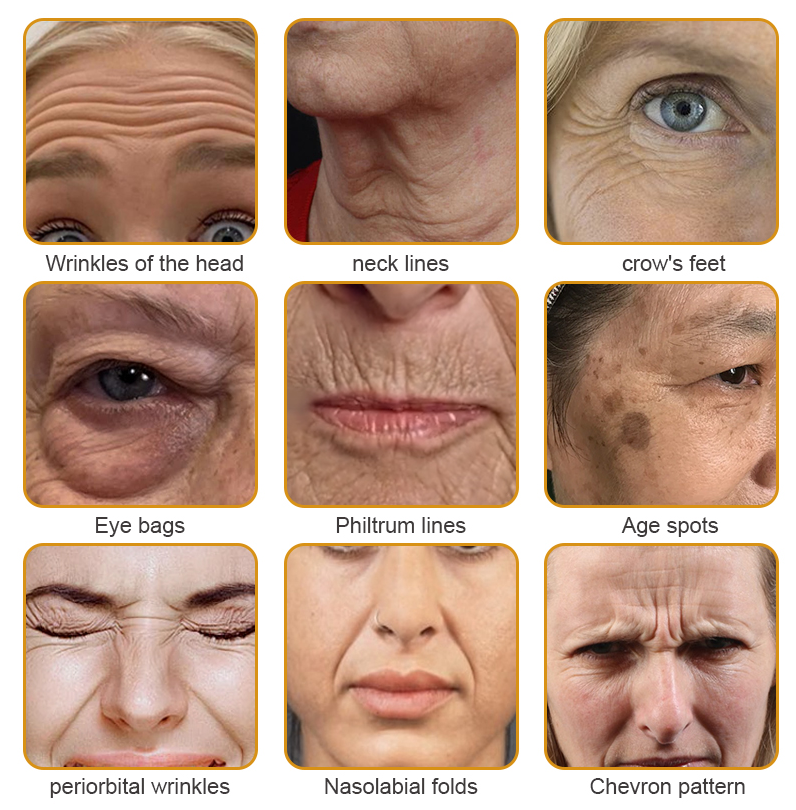 Ziprino® Bee Venom Botox Wrinkle Removal Cream🔥Made & Shipped from USA🐝LAST DAY 70% OFF